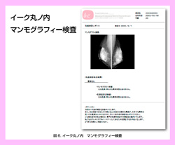 20131015_第二回乳がん６